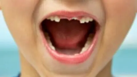 Los niños y el azúcar, un binomio peligroso de cara a estas Navidades: ¡cuando más aumentan las caries!
