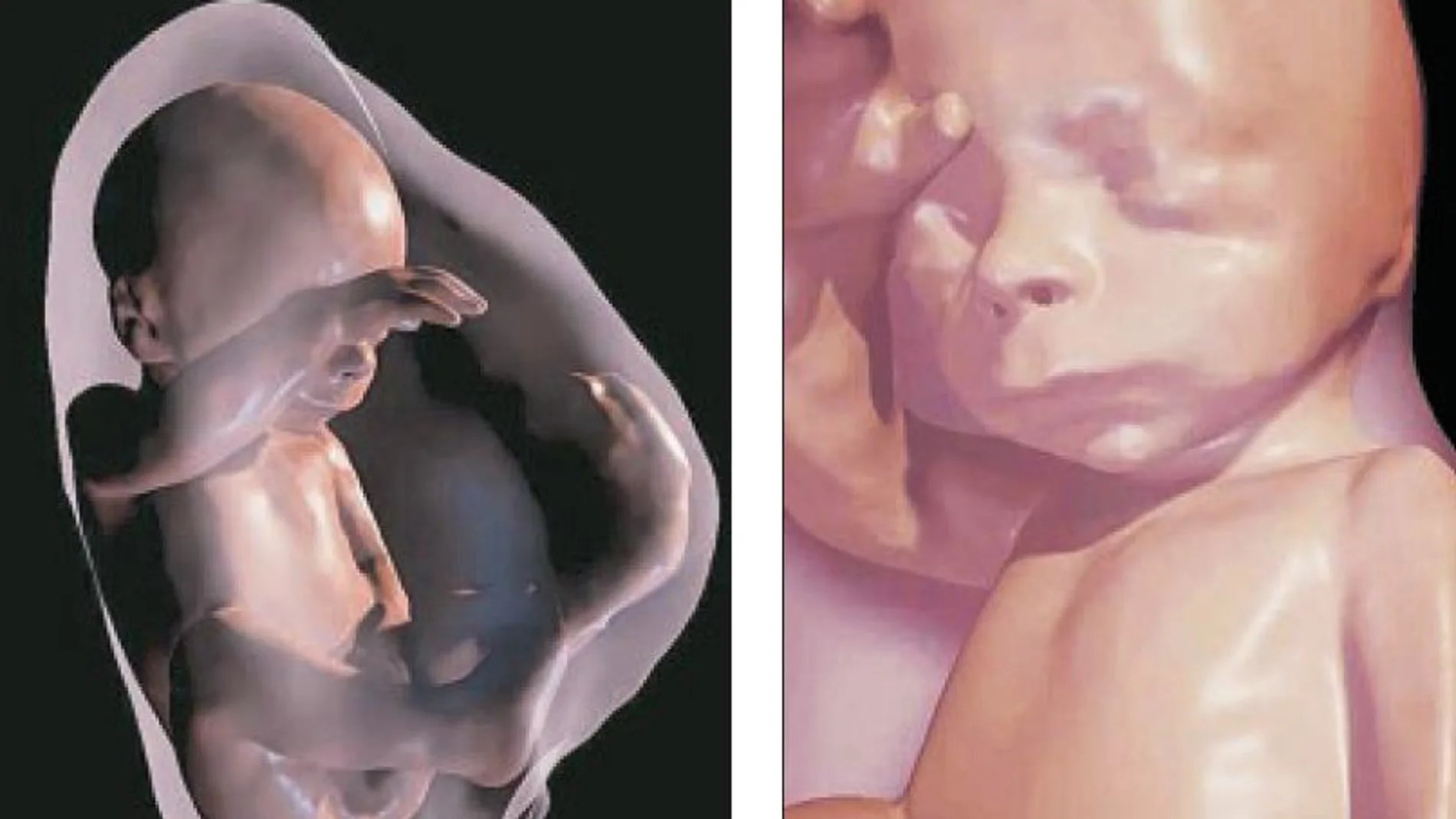 Modelo virtual 3D de imagen de resonancia magnética de un feto de 26 semanas