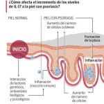 Dos aprobaciones europeas para Cosentyx en la espondilitis anquilosante y artritis psoriásica