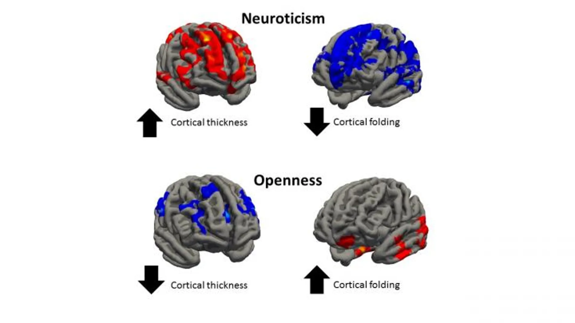 Variaciones cerebrales en casos de nerviosismo y apertura mental