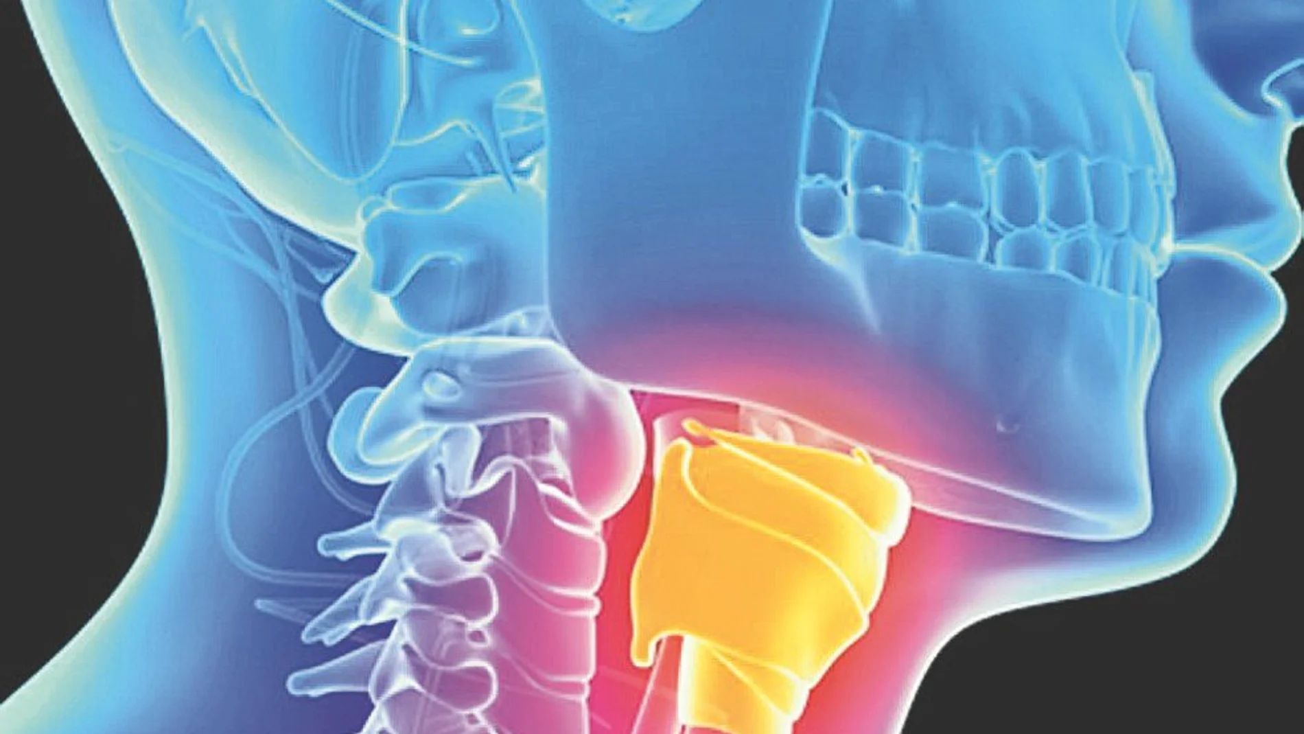 Con esta técnica se conservan las estructuras anatómicas de la laringe, que permitirán una mejor función respiratoria, fonatoria y deglutoria