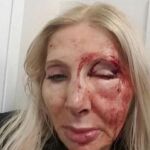 El rostro de la mujer tras ser brutalmente atacada
