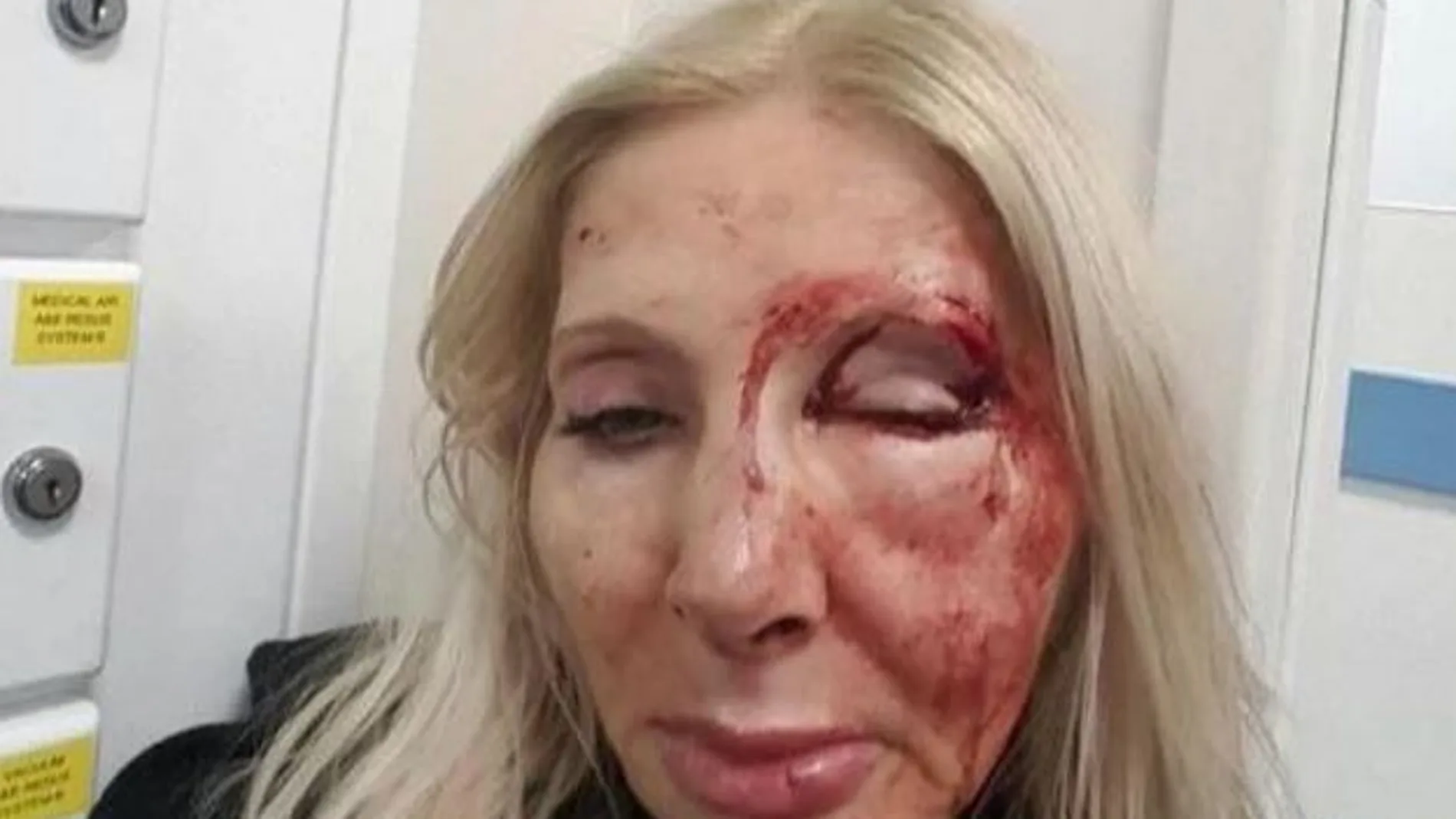 El rostro de la mujer tras ser brutalmente atacada