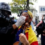 Wuilly Arteaga, de 23 años, suele tocar su violín en las manifestaciones contra el Gobierno, en Caracas. El sábado, sin embargo, recibió varios perdigonazos en la cara. El músico dijo que seguirá saliendo a la calle a tocar