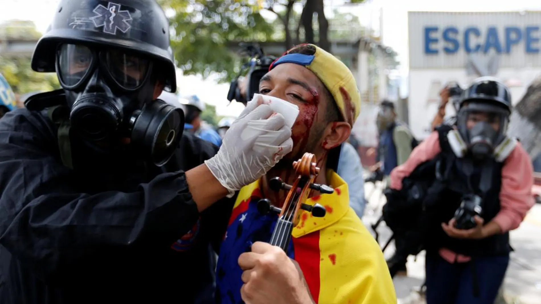 Wuilly Arteaga, de 23 años, suele tocar su violín en las manifestaciones contra el Gobierno, en Caracas. El sábado, sin embargo, recibió varios perdigonazos en la cara. El músico dijo que seguirá saliendo a la calle a tocar