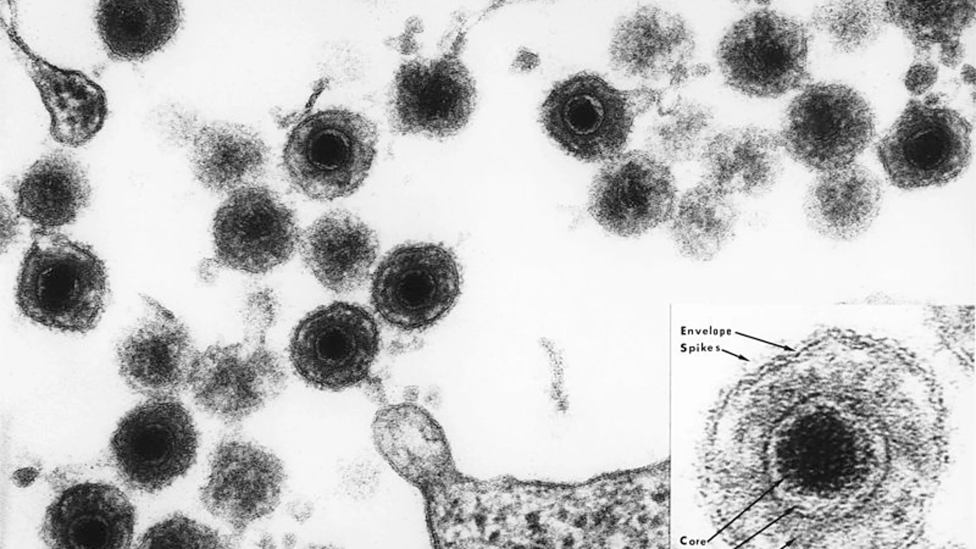 El virus HHV-6