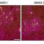 La imagen 1 muestra las células en el córtex de un ratón que no recibió terapia genética. La segunda, el córtex de un ratón que sí la recibió por lo que tuvo un menor número de placas amiloides