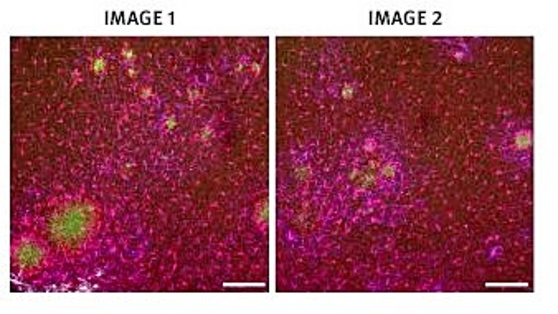 La imagen 1 muestra las células en el córtex de un ratón que no recibió terapia genética. La segunda, el córtex de un ratón que sí la recibió por lo que tuvo un menor número de placas amiloides