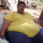 El hombre más obeso del mundo, con 435 kilos, pendiente de una operación que le salve la vida