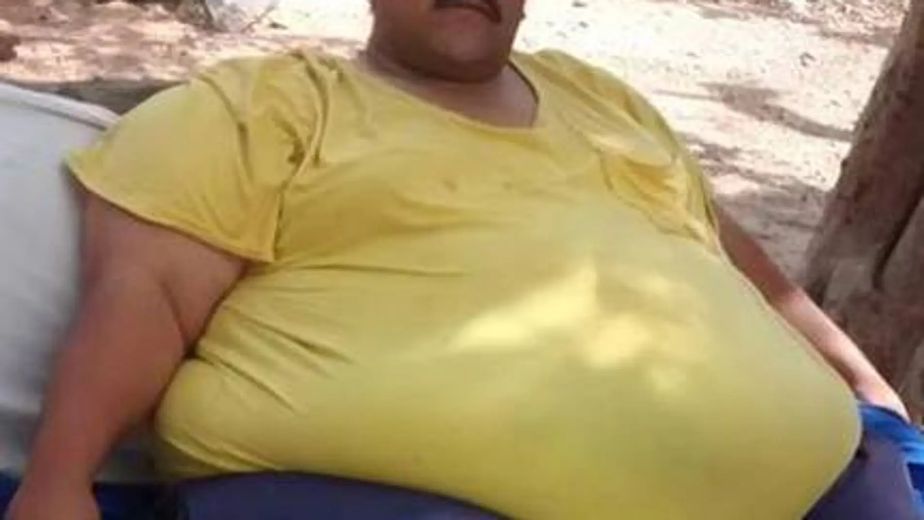 El hombre más obeso del mundo, con 435 kilos, pendiente de una operación que le salve la vida