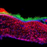 equipo de científicos ha logrado curar en ratones heridas de este tipo regenerando su piel ‘in vivo’, es decir, en el propio organismo y sin necesidad de un trasplante. Foto: Nature/Efe
