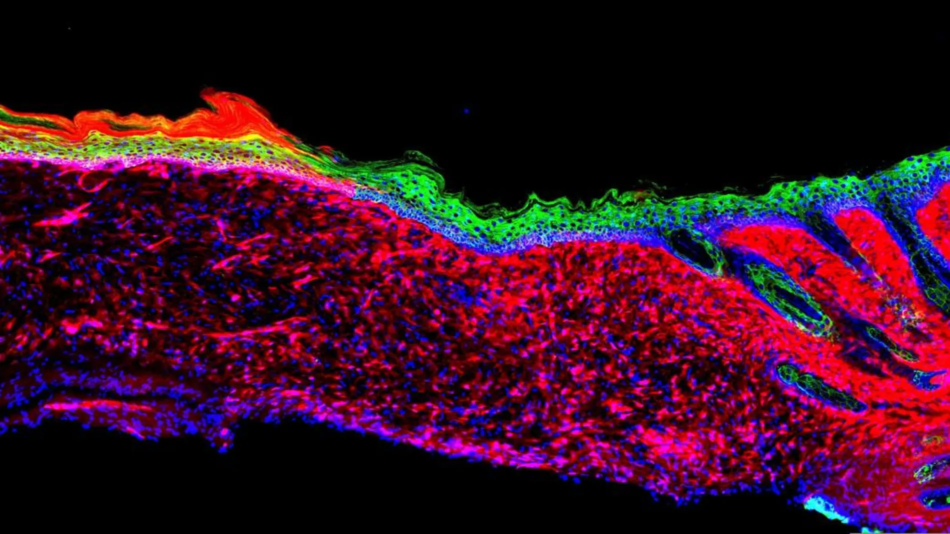 equipo de científicos ha logrado curar en ratones heridas de este tipo regenerando su piel ‘in vivo’, es decir, en el propio organismo y sin necesidad de un trasplante. Foto: Nature/Efe