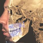 Primer escáner facial, nueva herramienta de diagnóstico radiológico