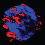Célula autoreactiva (azul) que capta los nanofármacos (rojo) que se agrupan en la membrana.