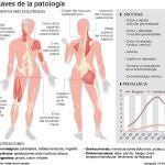 Abordaje genético para combatir los síntomas de la fibromialgia