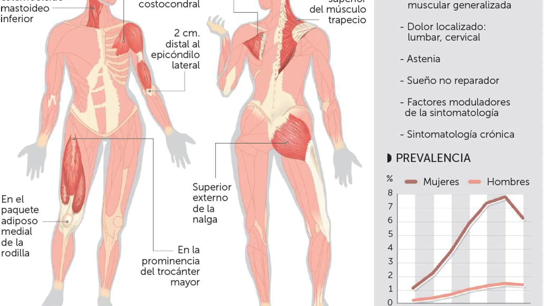 Abordaje genético para combatir los síntomas de la fibromialgia