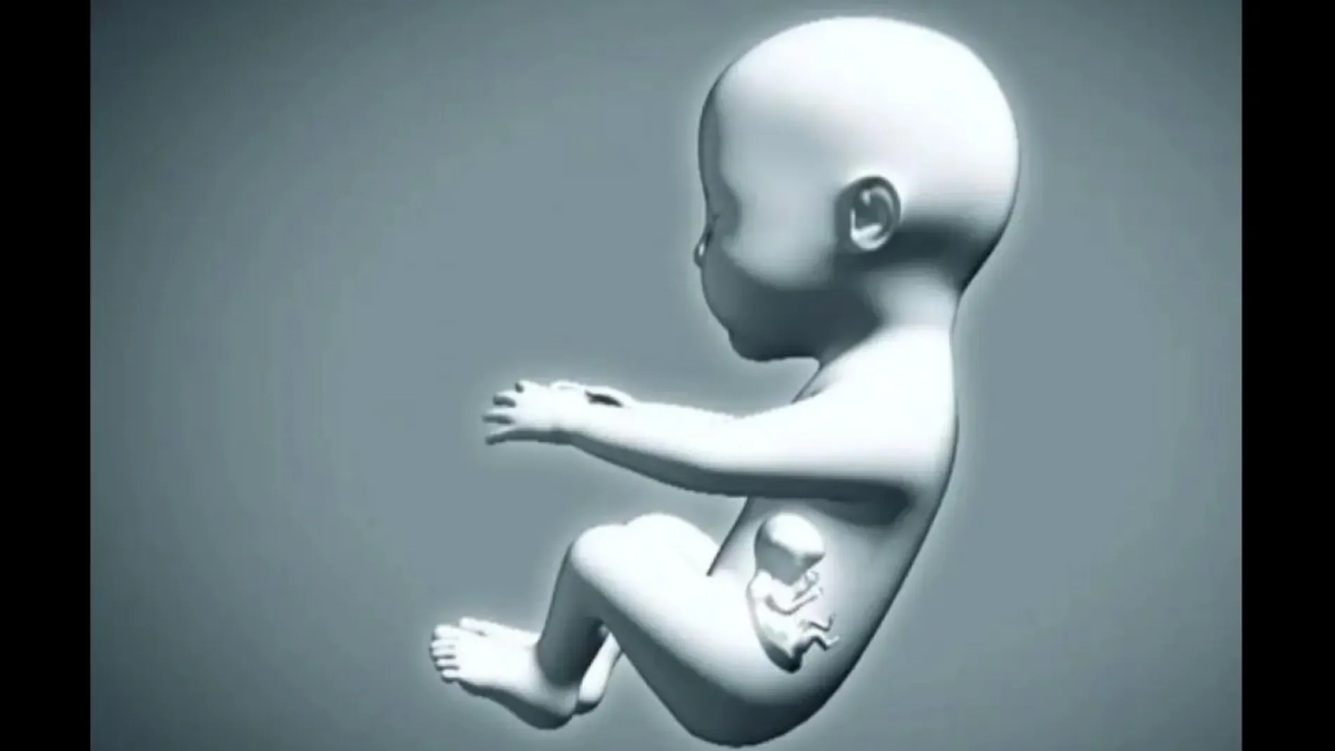Este fenómeno, llamado 'fetus in fetu' o 'gemelo parásito', es una alteración muy poco frecuente, que se da en uno de cada un millón de casos
