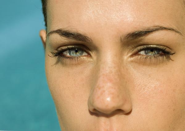 No son pecas, son manchas