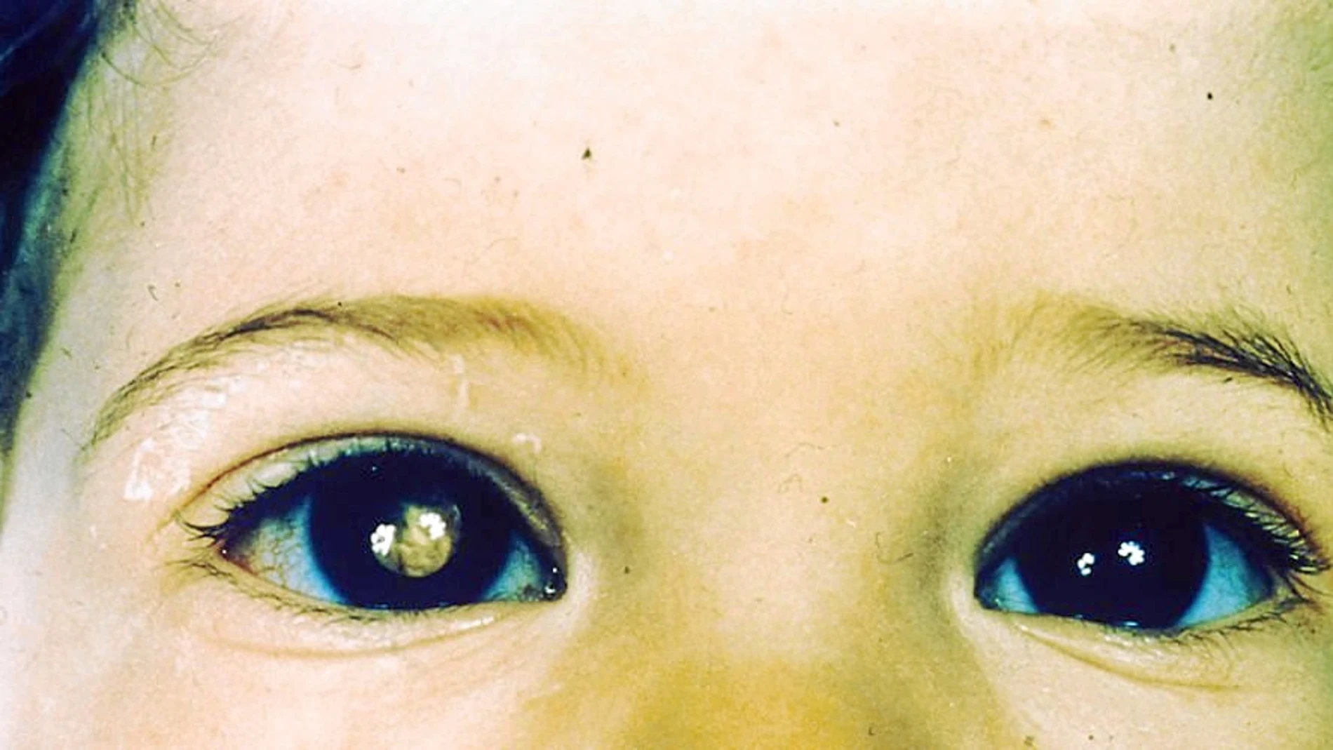 Imagen en primer plano de los ojos de un niño