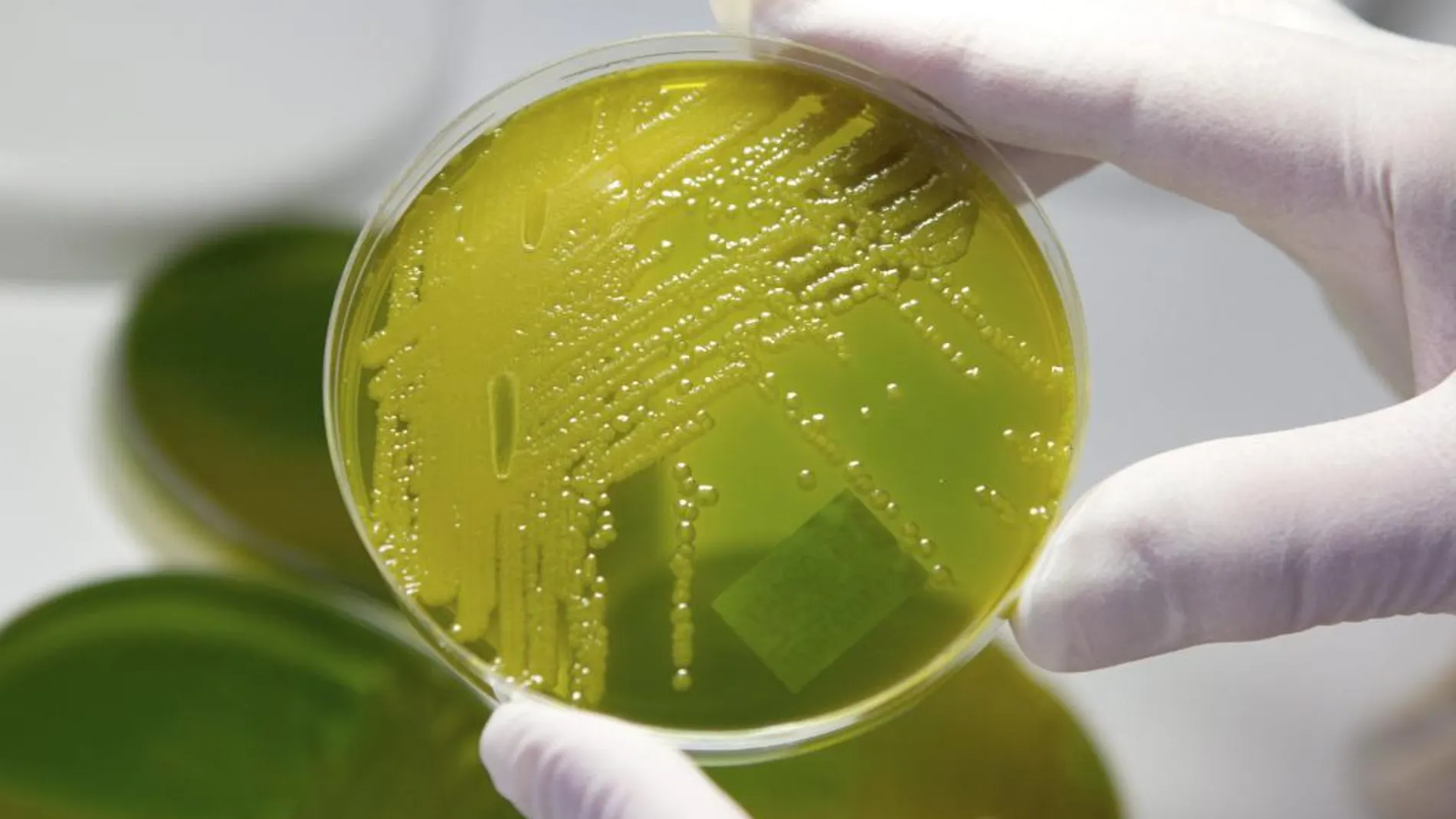 Una muestra de la bacteria E.coli que provocó decenas de muertos en Europa en 2011