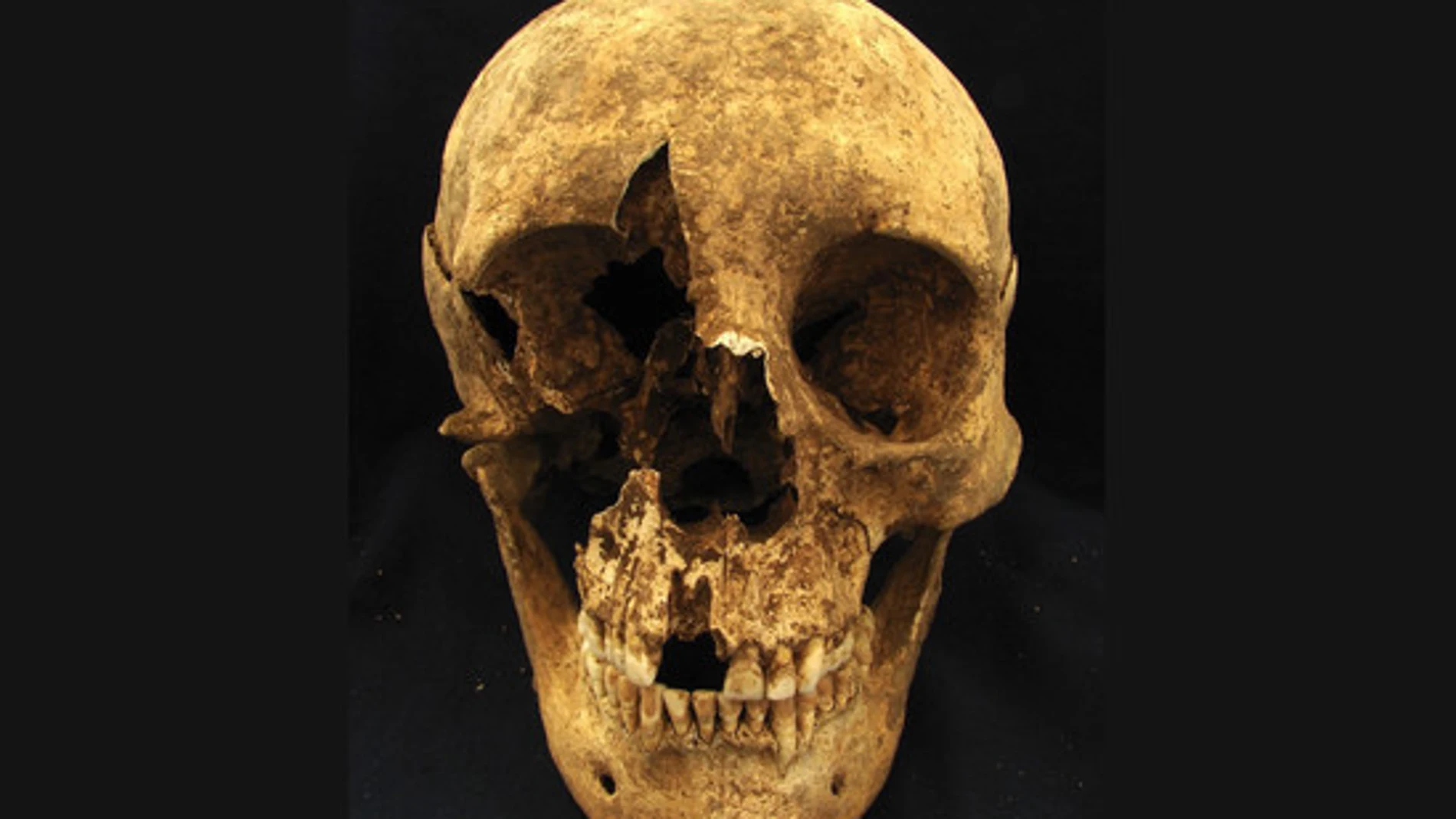 Calavera de uno de los esqueletos hallados en el cementerio romano de Casal Bertone (Italia)