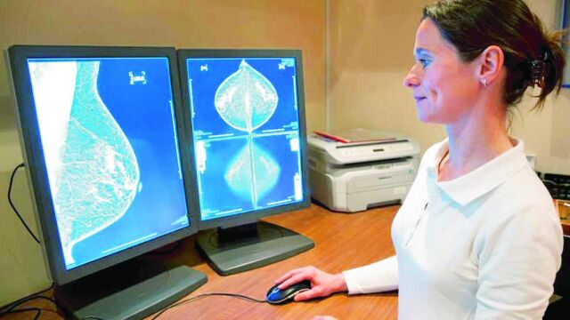 El cáncer de mama afecta cada año a 22.000 mujeres en España y su índice de supervivencia es casi del 83%.