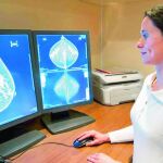 El cáncer de mama afecta cada año a 22.000 mujeres en España y su índice de supervivencia es casi del 83%.