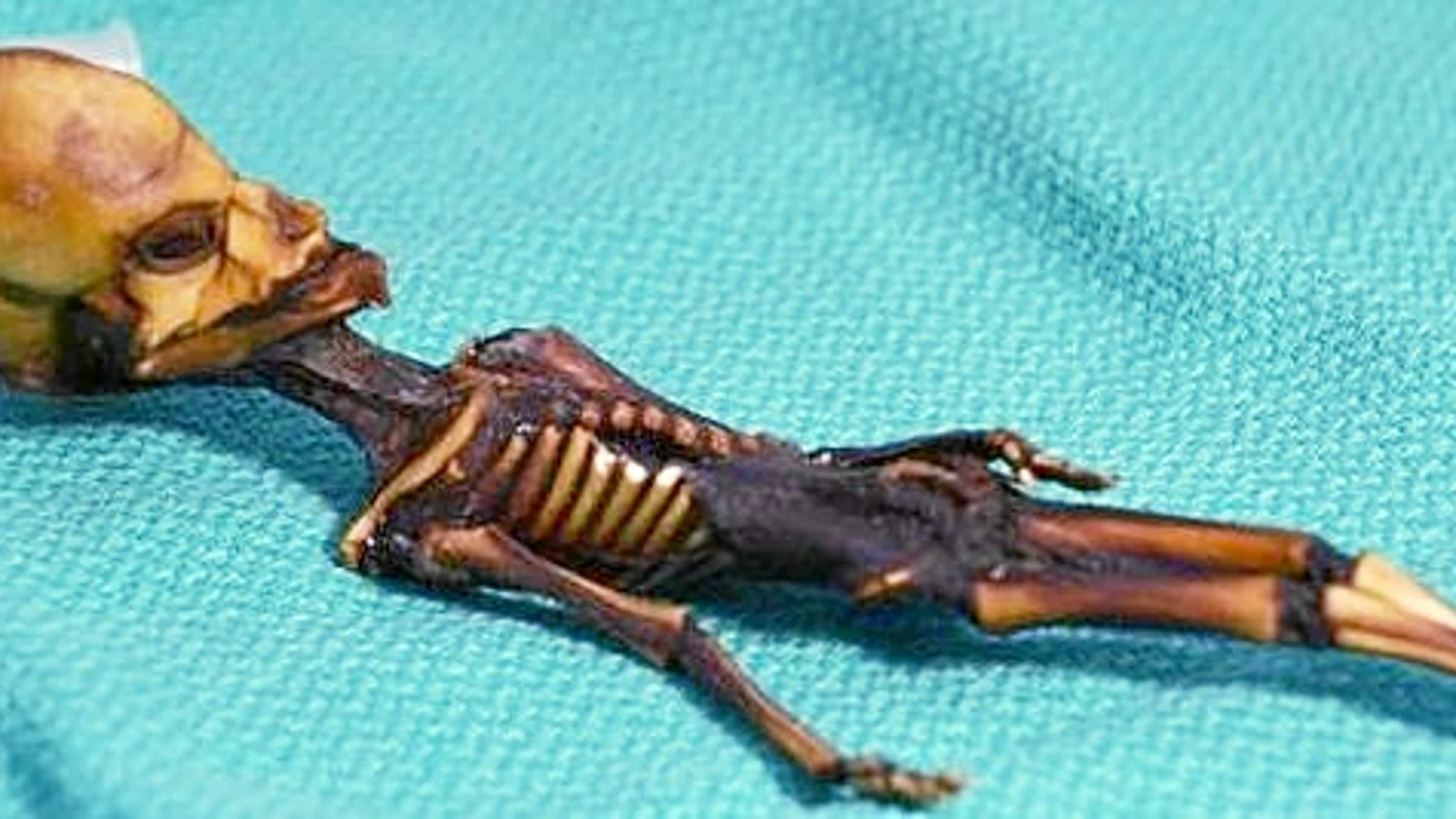 El cuerpo, de 15 centímetros de largo, consta de 10 pares de costillas y huesos que se asemejan a los huesos de una niña