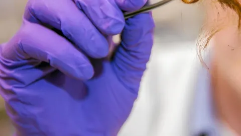 Cómo puedes frenar la caída del cabello después de la Covid-19