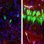 Imagen de las neuronas tintadas en verde que muestran la actividad del cerebro antes y después de la muerte cerebral.