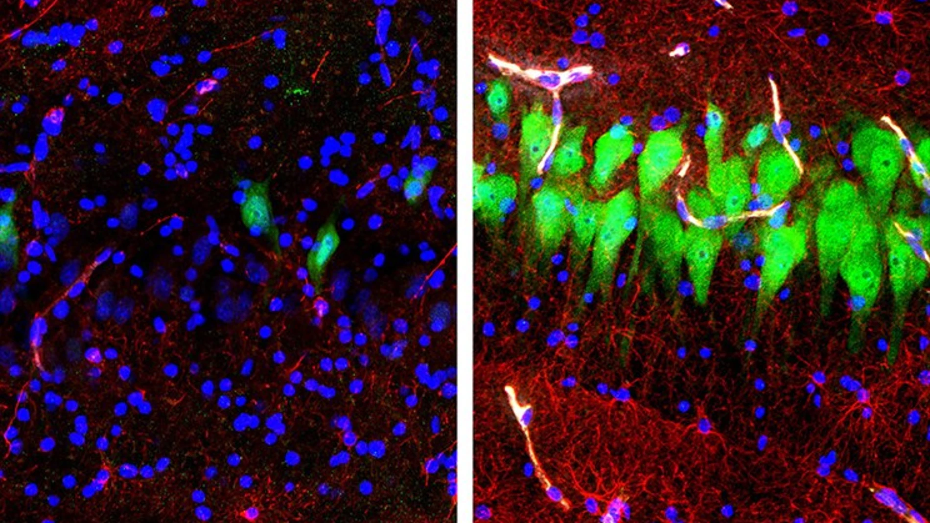Imagen de las neuronas tintadas en verde que muestran la actividad del cerebro antes y después de la muerte cerebral.