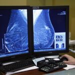 Los ginecólogos propondrán adelantar la primera mamografía a los 35 años