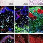 Los científicos han identificado las moléculas capaces de transmitir a la dermis las células cancerígenas