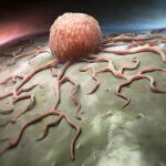 Una célula cancerígena vista al detalle