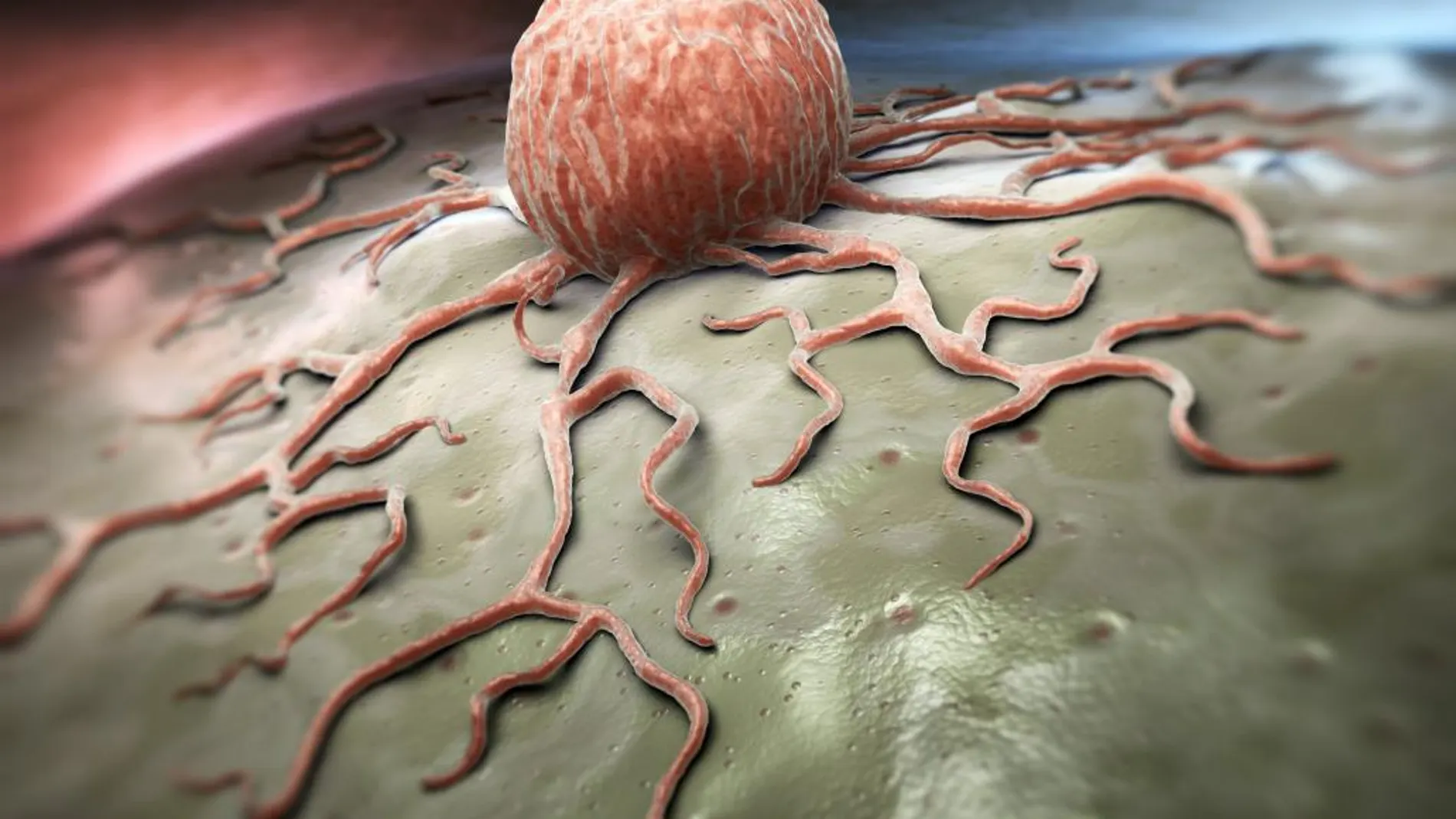Una célula cancerígena vista al detalle