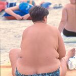 Las mujeres obesas tienen más problemas que los hombres
