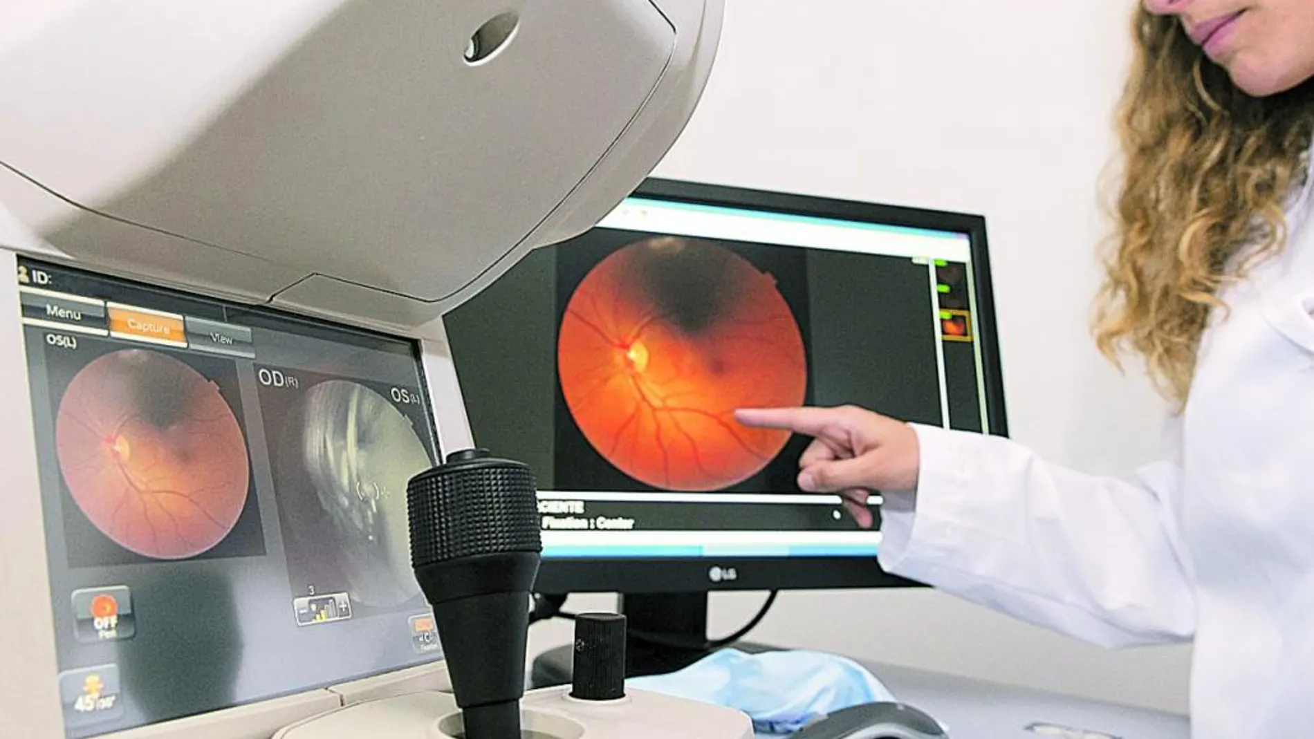 La retinopatía diabética afecta a 1 de cada 4 personas con diabetes
