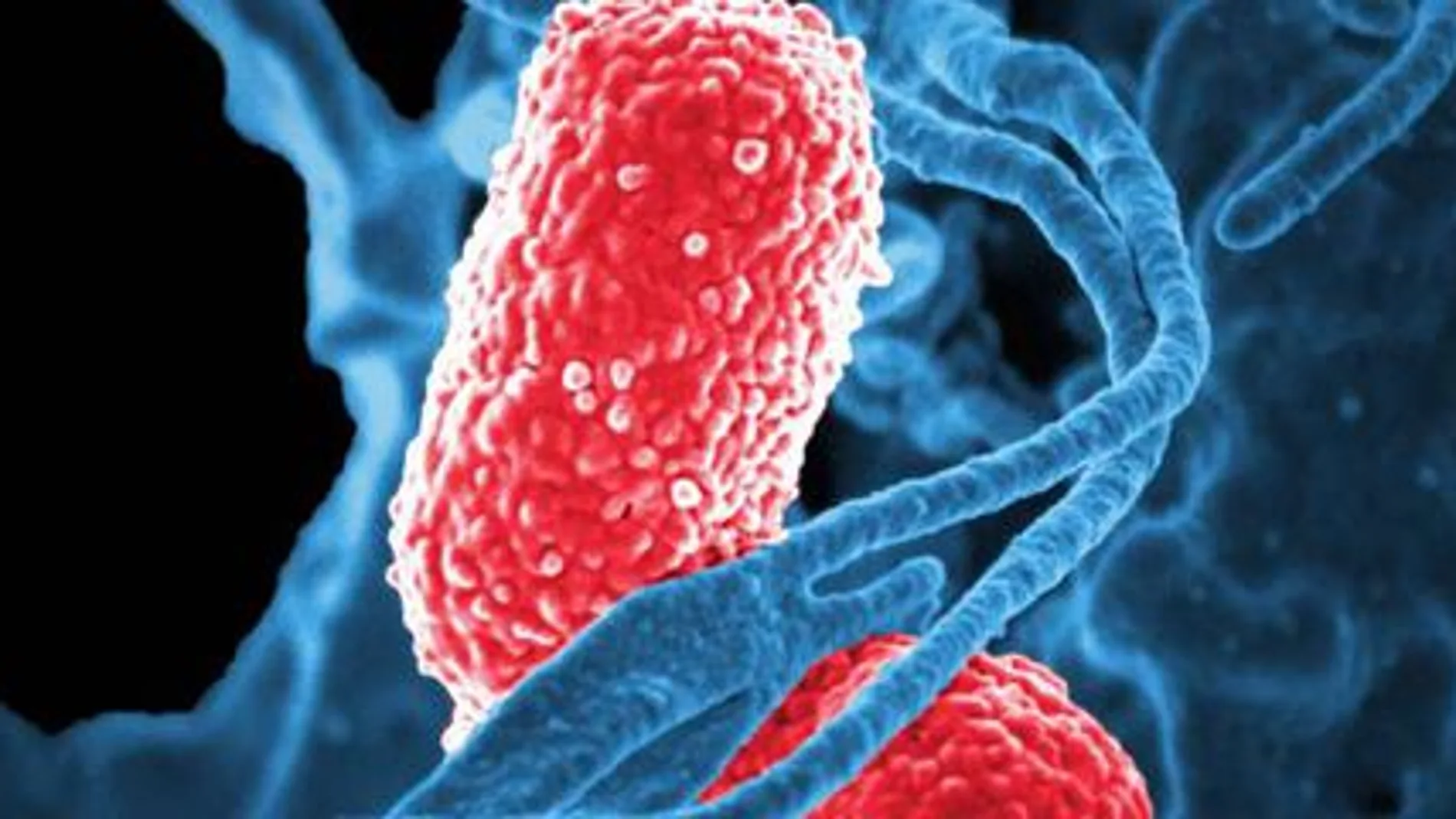 La bacteria klebsiella causó una sepsis a los pequeños prematuros