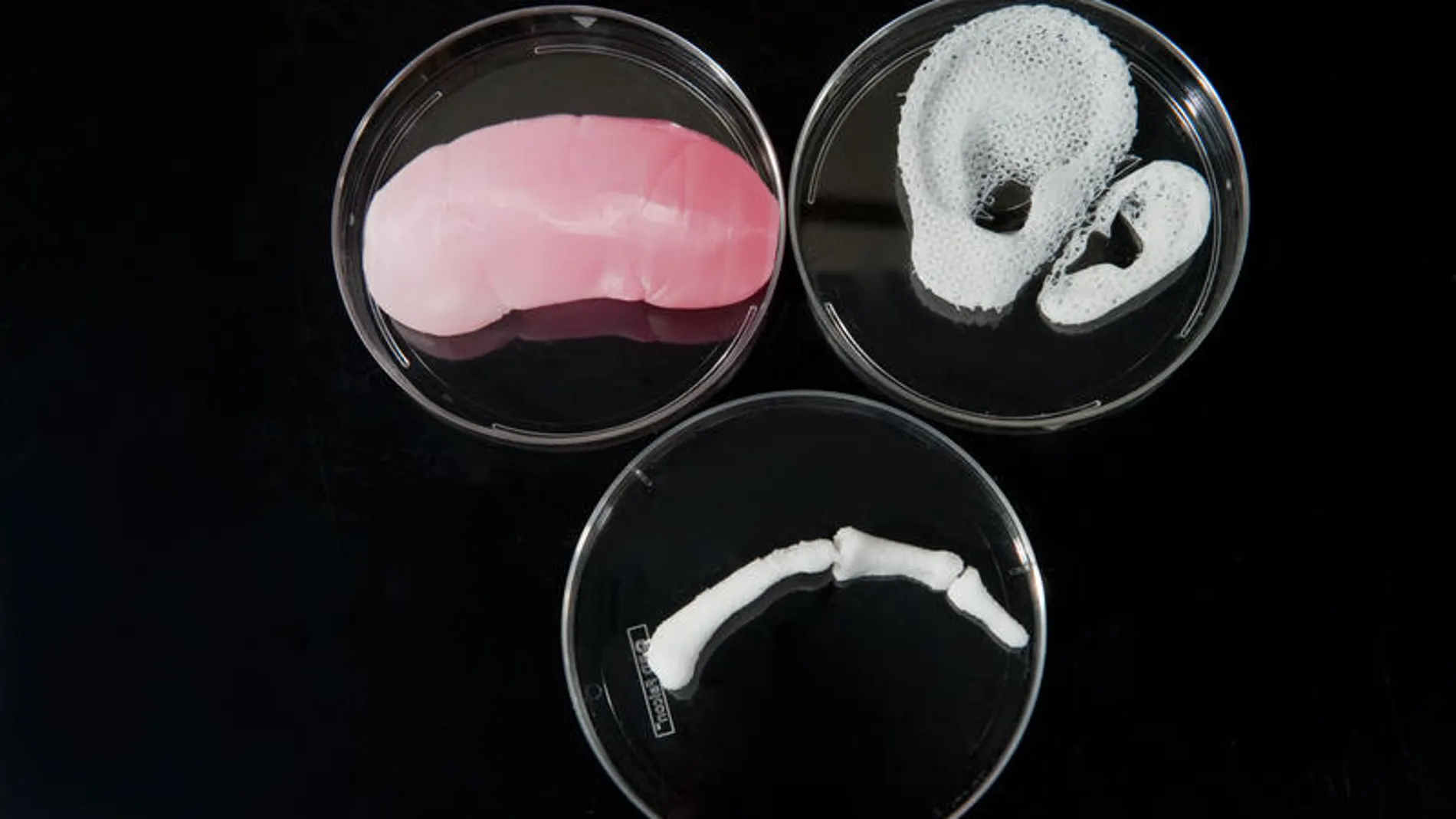 Un riñón, un dedo y una oreja imprimidos en 3D