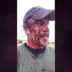 Un tipo sobrevive al ataque de un oso y se graba en vídeo antes de ir al hospital