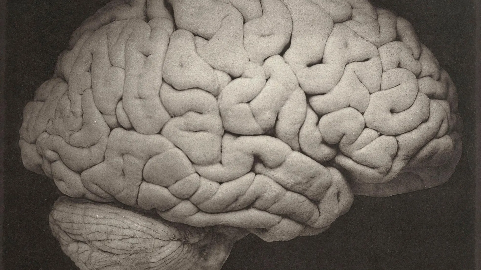 Imagen de un cerebro