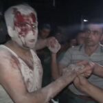 Un hombre herido tras un bombardeo en la ciudad siria de Alepo
