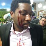 El actor de origen africano Marius Makon tras la agresión