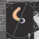 Los especialistas trabajan guiados por imágenes en tiempo real obtenidas con rayos X y ecografías que les permiten visualizar zonas anatómicas esenciales