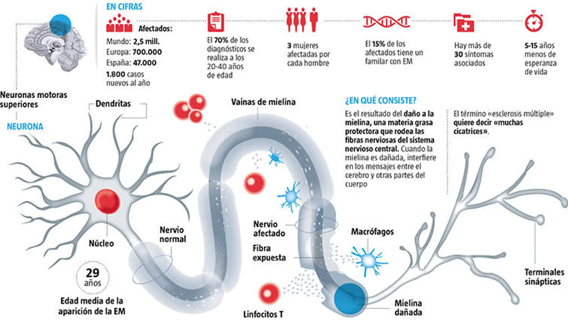 La esclerosis múltiple es una enfermedad de adultos jóvenes / Infografía LA RAZÓN
