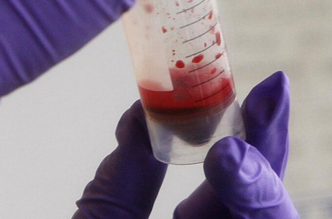 Sangre artificial, solución nipona para el suministro global de transfusiones