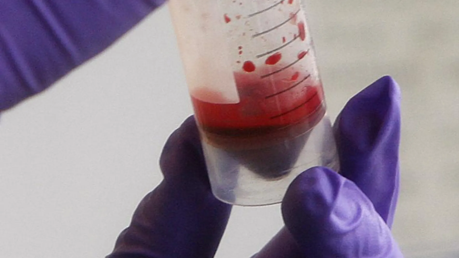 Sangre artificial, solución nipona para el suministro global de transfusiones