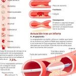 “Tras un infarto, lo más importante es controlar los factores de riesgo cardiovascular y no descuidar las revisiones” | Infografía La Razón