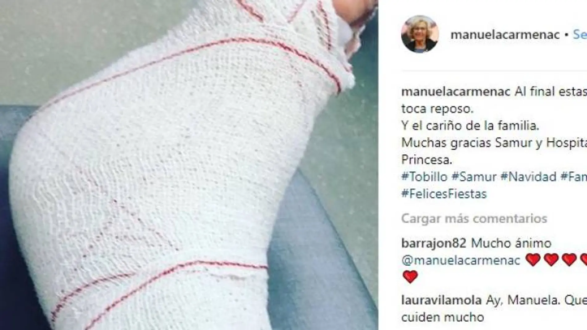 Manuela Carmena informó de la caída en su cuenta de Instagram