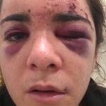 Andrea Scignano, de 27 años, publicó esta foto a través de su cuenta de Facebook